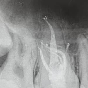 Comprehensive Advanced Endodontics